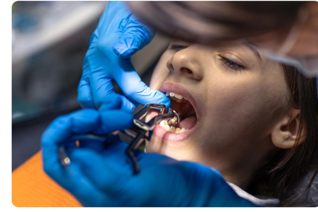 low cost braces in pune